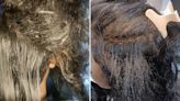 The busiest week for head lice is coming up, here's how to protect your kids