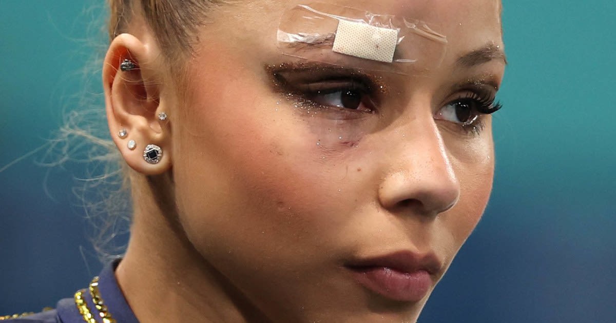What happened to Flavia Saraiva? Brazilian gymnast has bandage over eyebrow