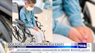 Alabama mom warning parents after son gets uncommon side effect from flu