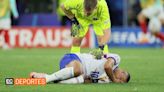 (Video) Kylian Mbappé se rompe ¿Se termina su Eurocopa?