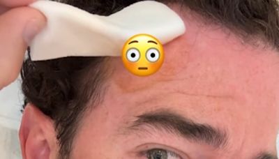 Kevin Jonas revela que ha tenido que pasar por quirófano por un cáncer de piel