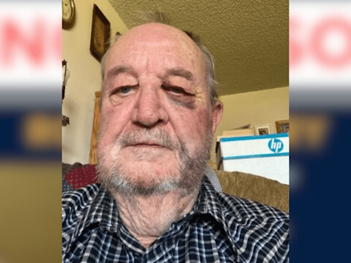 Search underway for 71-year-old man who went missing in Sacramento