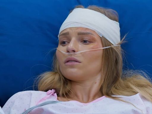 Irina Baeva ensangrentada: la actriz comparte fotos de su accidente en tv