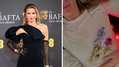 How to check your breasts for lumps as Millie Mackintosh shares cancer scare