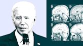 A brain expert explains the cognitive test used to assess a president's mental fitness. It's not easy.