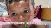 Un cirujano de EEUU desplazado a Gaza denuncia que los francotiradores israelíes disparan a niños palestinos