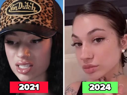 17 Celebs Who've Dissolved Their Facial Fillers Or Stopped Getting Lip Fillers