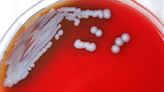 Bacteria that causes rare tropical disease found in US soil