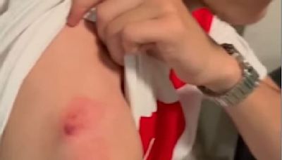 Euro 2024: un fan croate mordu par une femme pour récupérer le maillot d’Ivanusec