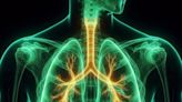 Severe complication from lung transplantation has been underestimated, researchers find