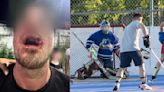 Ball hockey player brutally beats referee with stick | Offside