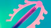 IUD Insertion Pain: Causes and Why It's Often Downplayed