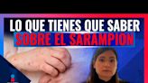 Se reportan siete casos de sarampión en México