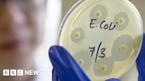 Ecoli outbreak in UK most likely linked to food item
