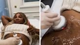 Serena Williams Gets Tummy-Tightening Procedure For Pre-Kids Confidence