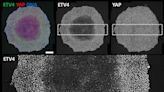 Researchers reveal new cellular mechanical transducer