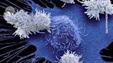 Do cutting-edge CAR-T-cell therapies cause cancer? What the data say