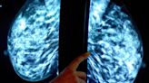 Women who begin menopause early face double the risk of breast cancer, study finds