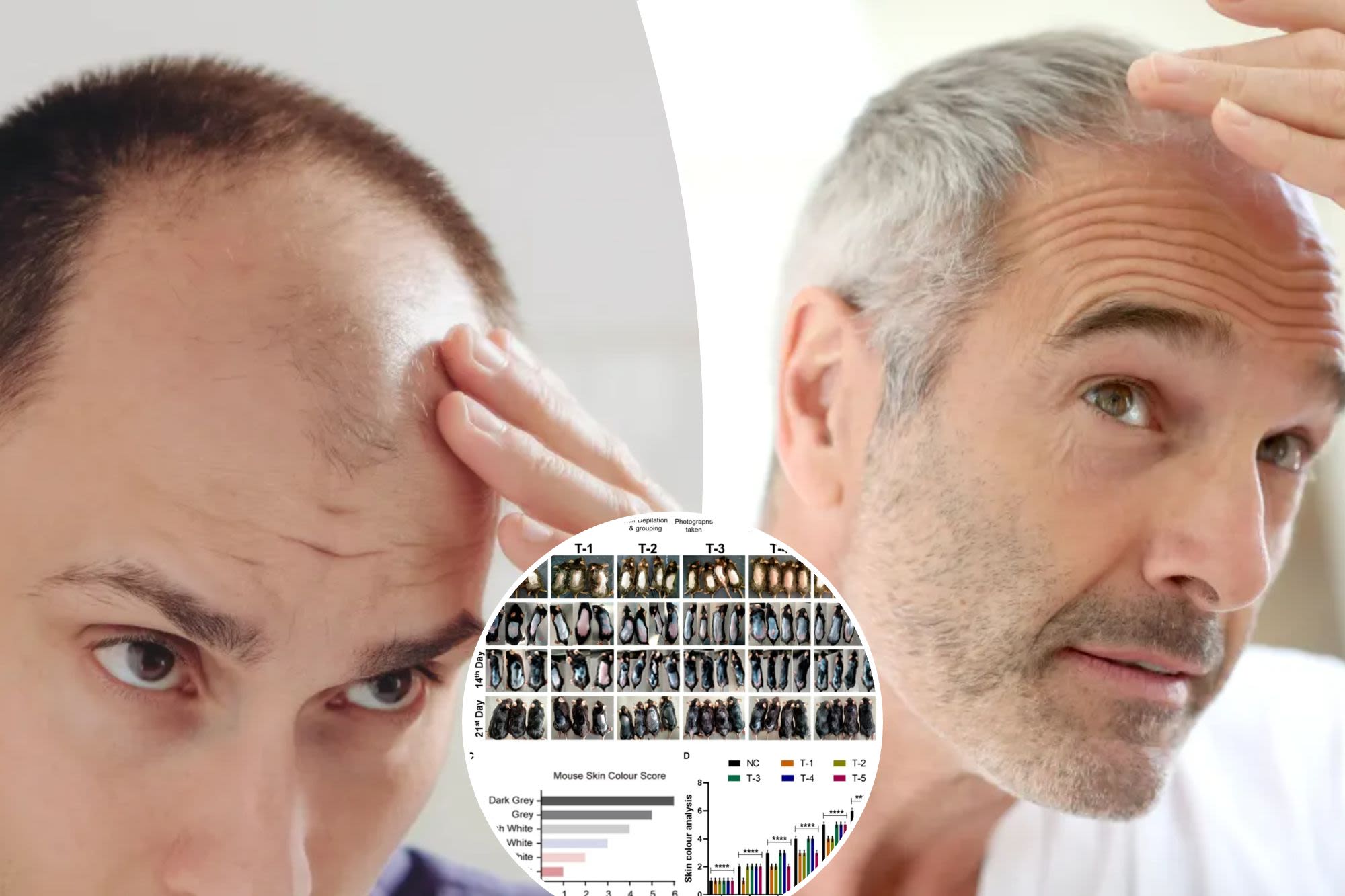 A breakthrough for baldness? Sugar gel stimulates hair regrowth