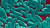 'Flesh-eating' bacteria kill 3 in New York and Connecticut