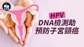 HPV｜DNA檢測助預防子宮頸癌