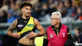 Injury-hit Tigers confirm ACL rupture for Lefau