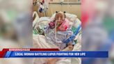 Nursing couple in need of financial help as daughter fights for her life in lupus battle