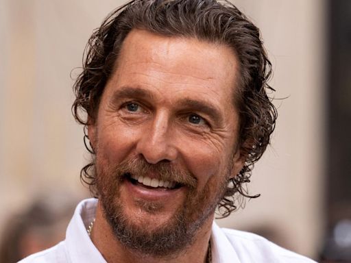 Matthew McConaughey Shares Wince-Inducing Close-Up Of Bee-Stung Face