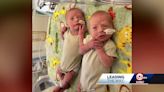 Help pouring in for twins denied life-changing medical treatment by insurance company