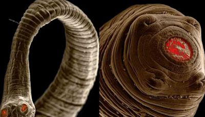 Muestran espeluznantes imágenes de parásitos intestinales
