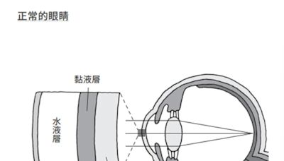 眼睛乾澀好疲勞，拼命點人工淚液？醫教「毛巾熱敷法」5分鐘能舒緩