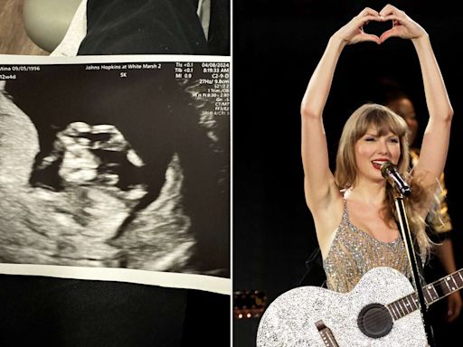 Pregnant Swiftie Spots Her Baby Making Taylor Swift's Signature 'Heart Hands' in Sonogram (Exclusive)