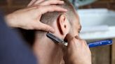 Zahl der Fälle steigt - Hautpilz nach Barbershop-Besuch: "Mehr schwerere Infektionen und erschwerte Behandlung“