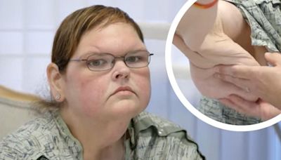 '1000-Lb. Sisters' Star Tammy Slaton Is 'Afraid' but Ready for Loose Skin Removal Surgery