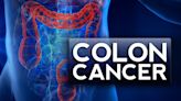 Colon Cancer Awareness Month: risks, symptoms and when to get screened