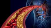 Día Mundial de la Hipertensión Arterial: cuáles son los signos de esta enfermedad que cada vez suma más adeptos