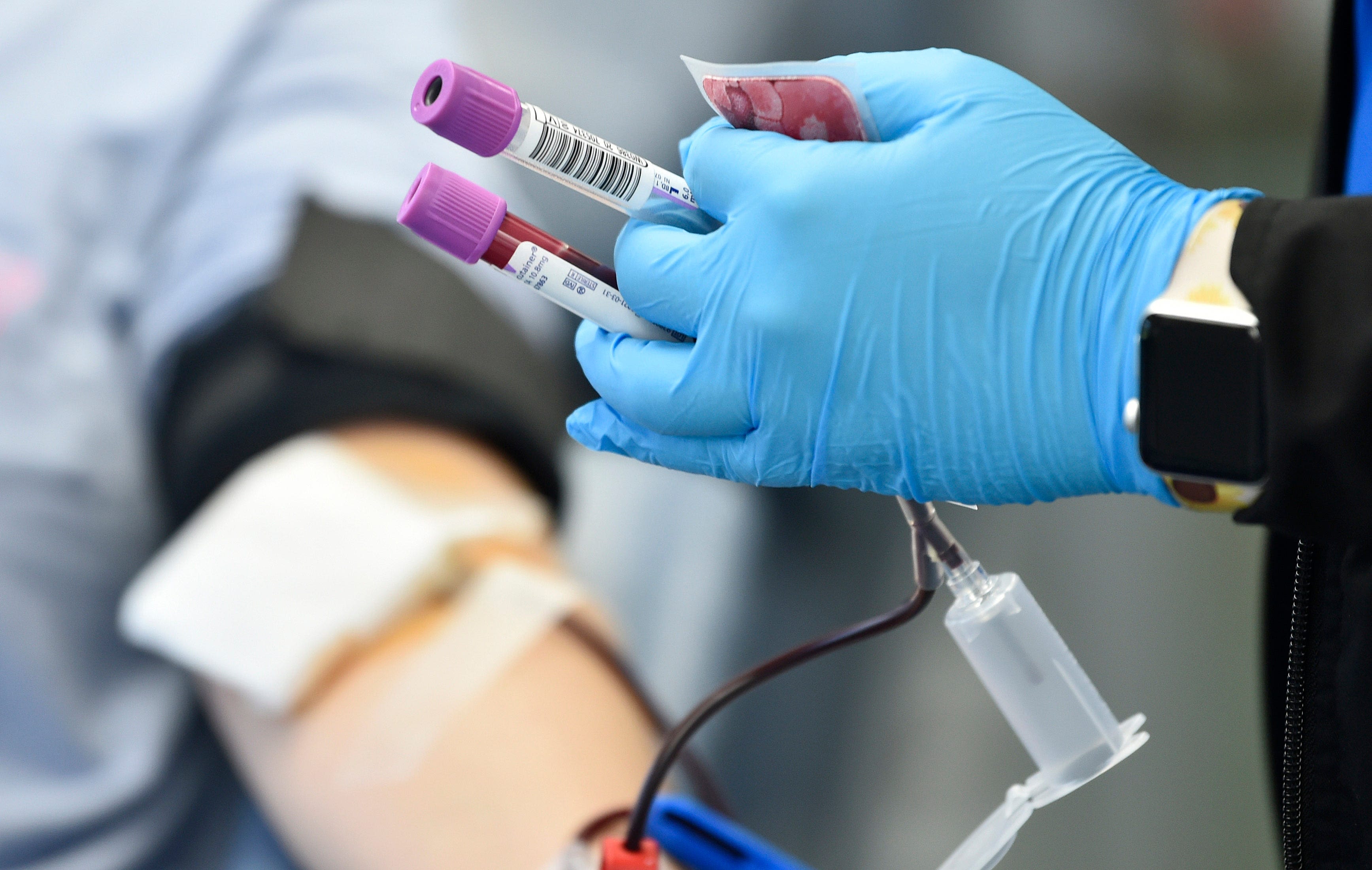 Suncoast Blood Centers seeks donors after recent complex surgeries strain supply