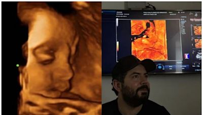 José Eduardo Derbez y Paola Dalay comparten ultrasonido de su bebé