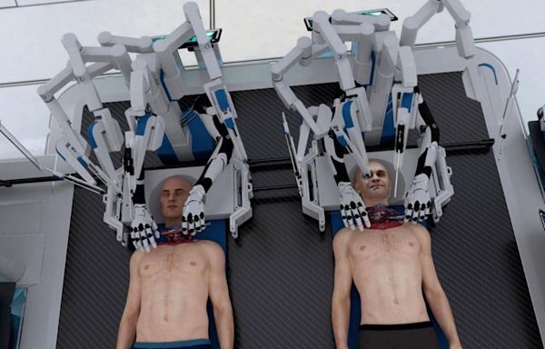 Company unveils how world’s first head transplant would work
