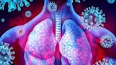 Long COVID inflicts deep scars on the lungs, but targeting specific immune cells could reverse damage − new research in mice - ET HealthWorld