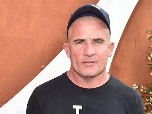 GRAPHIC WARNING: Tish Cyrus's new husband Dominic Purcell reveals his gruesome injuries after horrific accident on set