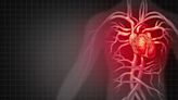 Insuficiencia cardíaca: por qué la atención ambulatoria puede ser más eficaz que la internación
