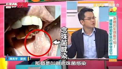 婦嘴巴內像「撒滿起司粉」喊痛！ 血糖一測：糖尿病了