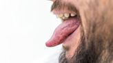 Your tongue could be telling you something very worrying about your health