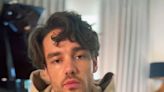 Liam Payne Cancels Tour After Being Hospitalized with a 'Bad Kidney Infection': 'Sorry'