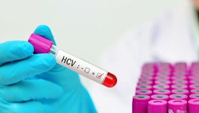 Spain is poised to be a leader in eliminating hepatitis C