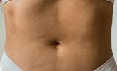 Navel