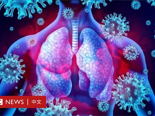 BBC健康事務記者：我躲過新冠病毒了嗎，這可能意味著什麼？