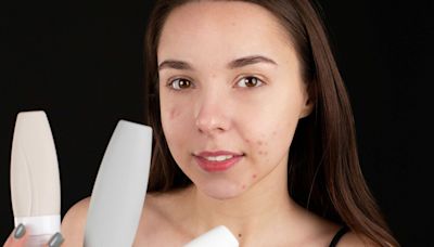 Adult hormonal acne: A guide to understand and treat the problem | Mint