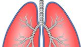 Hypoxemia due to sleep apnea is associated with risk of lung cancer reoccurrence